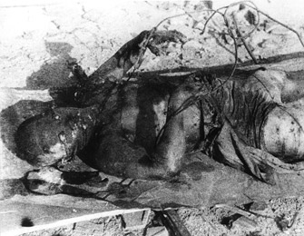 Victima de Hiroshima